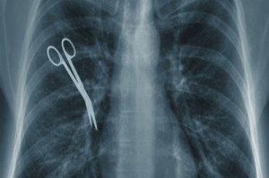 X-ray image of ribs and surgical scissors
