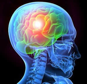 X-ray image of skull with illustration of brain highlighted