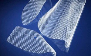 Alabama Transvaginal Mesh Lawsuit Attorney