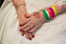 elderly woman’s bruised hands folded over a blanket on her lap