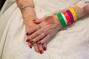 elderly woman’s bruised hands folded over a blanket on her lap